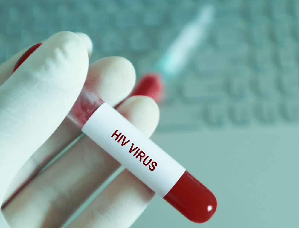 doctor holding a vial that says HIV virus