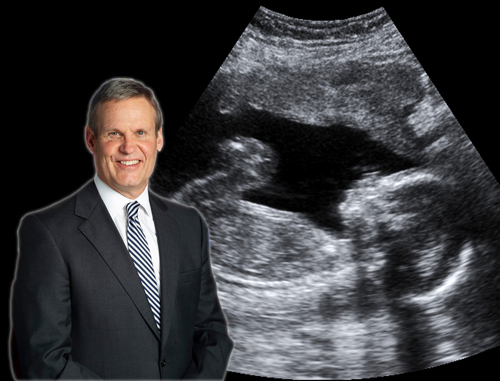 Governor Bill Lee and an ultrasound of a baby in the womb