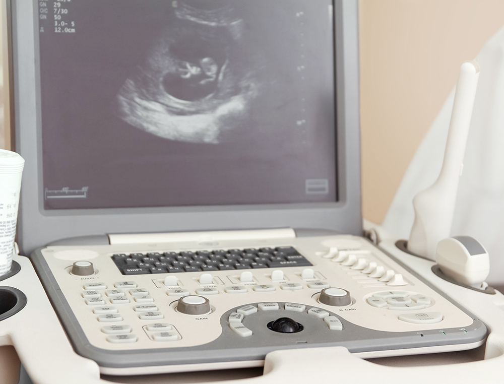 ultrasound 