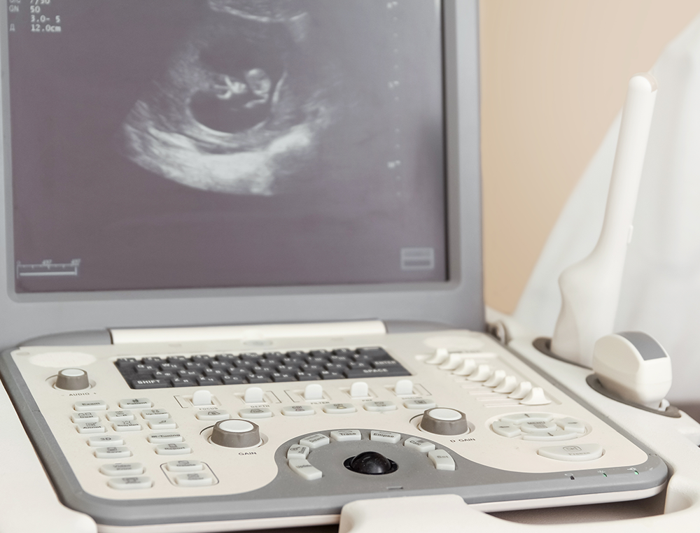 ultrasound scan