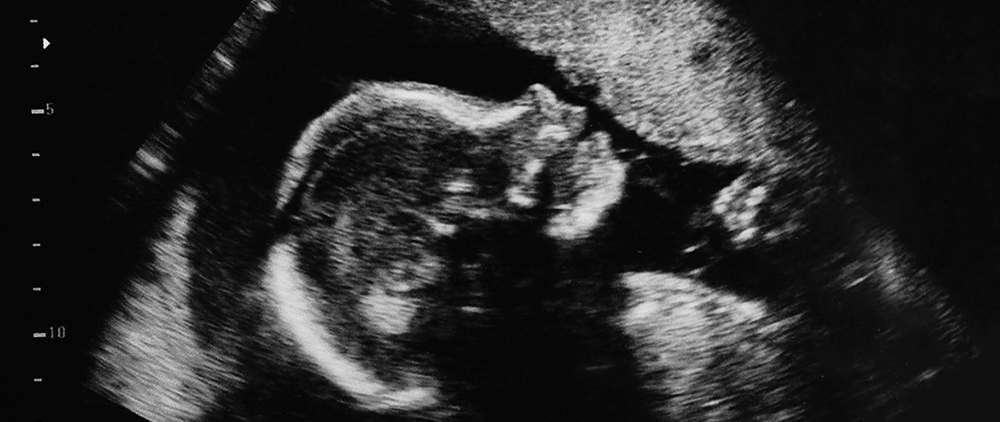 What SCOTUS Abortion Ruling Means for TN’s New Abortion Law