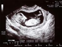 Georgia Heartbeat Bill