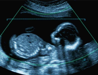 Sanctuary For Unborn Texas