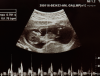 Circuit Court Stops Trump Admin. from Enforcing Title X Ban on Funding Abortion Clinics