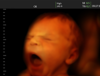 Federal Government Required to Arrange Abortions for Minor Illegal Immigrants