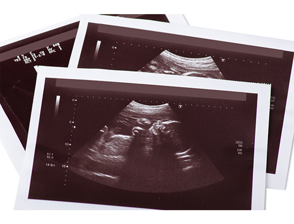 Planned Parenthood Seeks Supreme Court Overturn of HHS Rule Barring Abortion Facilities, Referral Sites From Title X Funding