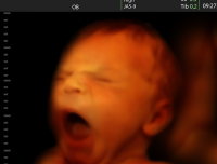 US Signs International Consensus on Women’s Health Declaring There Is No Universal ‘Right to Abortion’