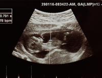 Ohio legislature passes bill requiring humane burial for aborted babies