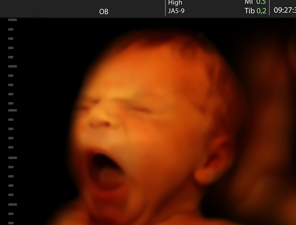 Ohio Gov. Signs Bill Requiring Women To Cremate Or Bury Aborted Fetus