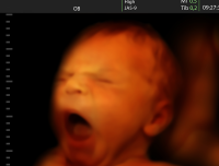 Ohio Gov. Signs Bill Requiring Women To Cremate Or Bury Aborted Fetus