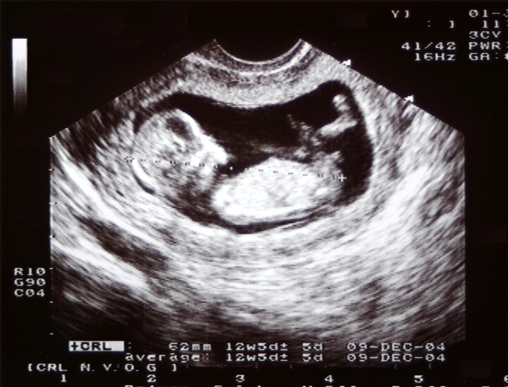 Missouri Becomes First Abortion-Free State 