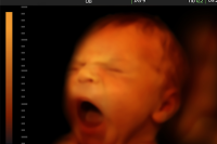 Arkansas Passes Near-Total Abortion Ban 