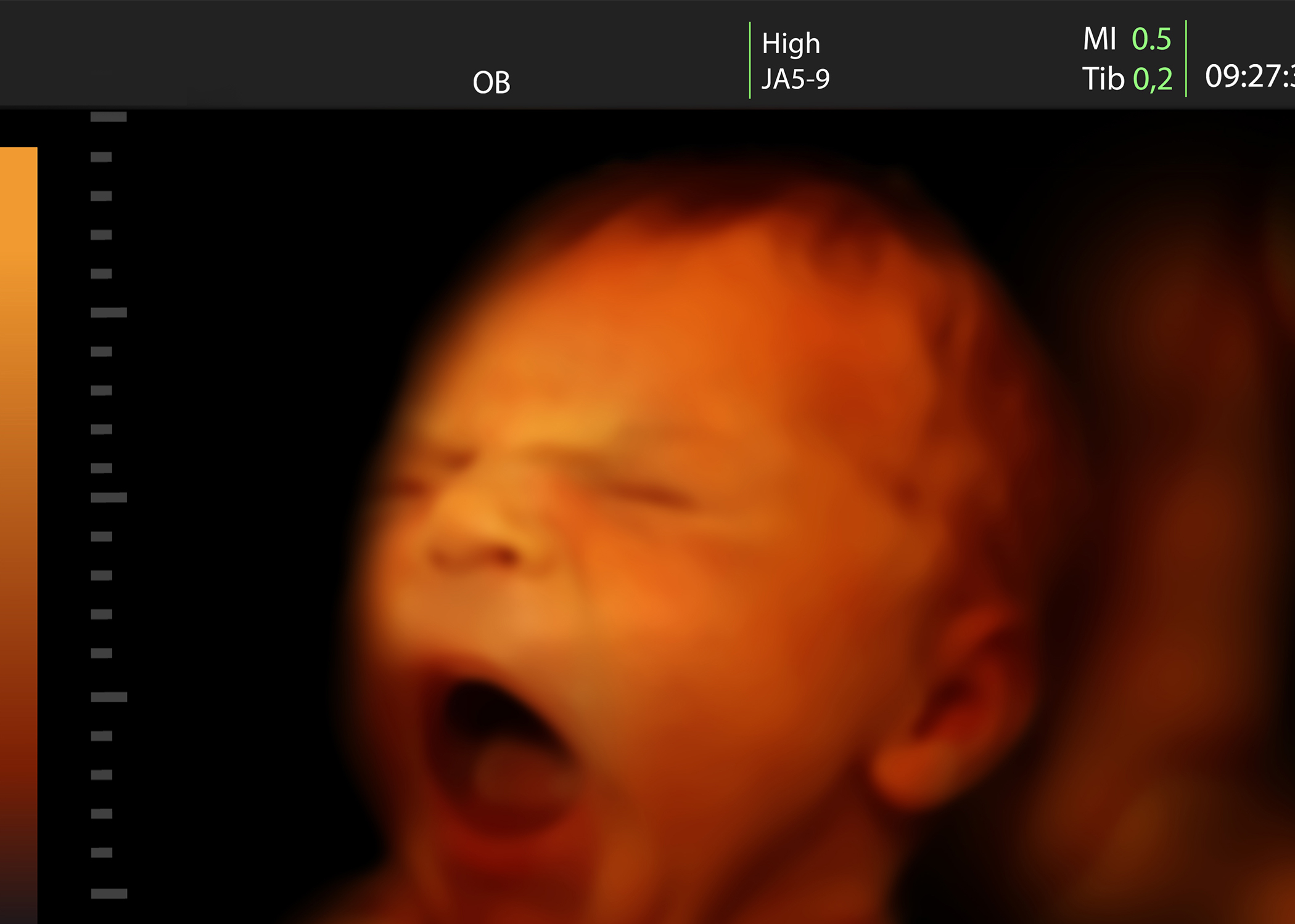Ребенок плачет в утробе. 3д снимок ребенка в утробе. Снимок лица ребенка в утробе матери.