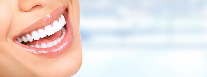 How Veneers Can Revamp Your Smile