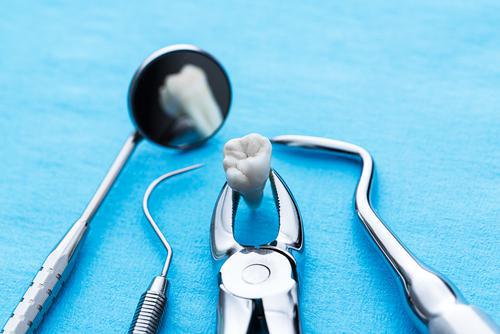 Dental Implants: Why They're Your Best Choice for Replacing Missing Teeth