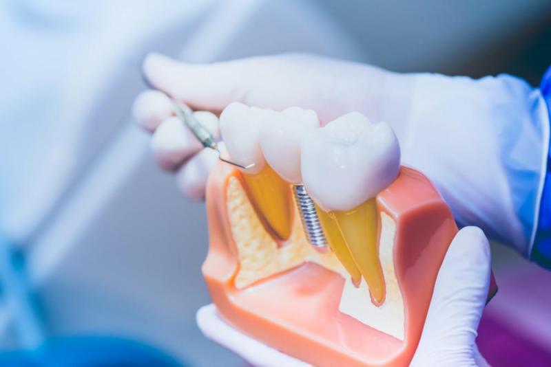 Missing a Tooth? Here's Why You Should Fix The Problem With a Dental Implant
