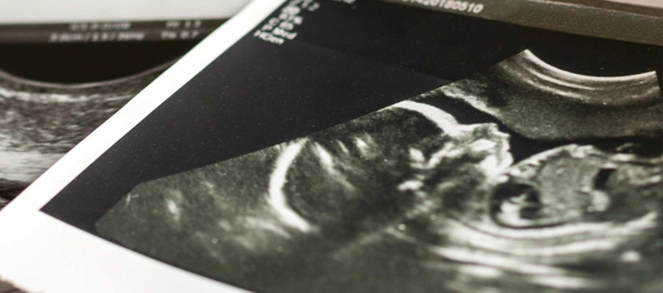 Talking ‘Smack’ to SCOTUS on Roe v. Wade?