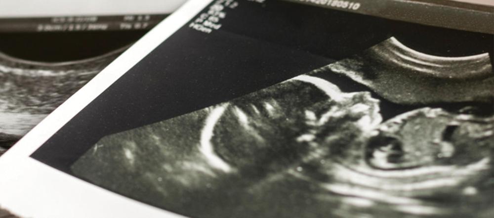 Talking ‘Smack’ to SCOTUS on Roe v. Wade?