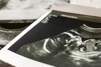 The Constitutional Government Defense Fund and Family Action Council of Tennessee File Amicus Brief Asking Supreme Court to Overturn Roe v. Wade