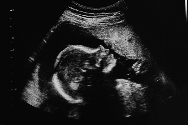 Federal Court Blocks Biden Policy That Would Have Forced Christian Doctors to Do Abortions