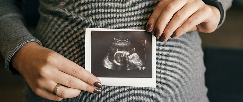 Will SCOTUS ‘Abort’ All of Us?