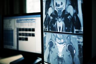 X-ray showing injury and need to contact the Oregon car accident lawyers at Metier Law Firm