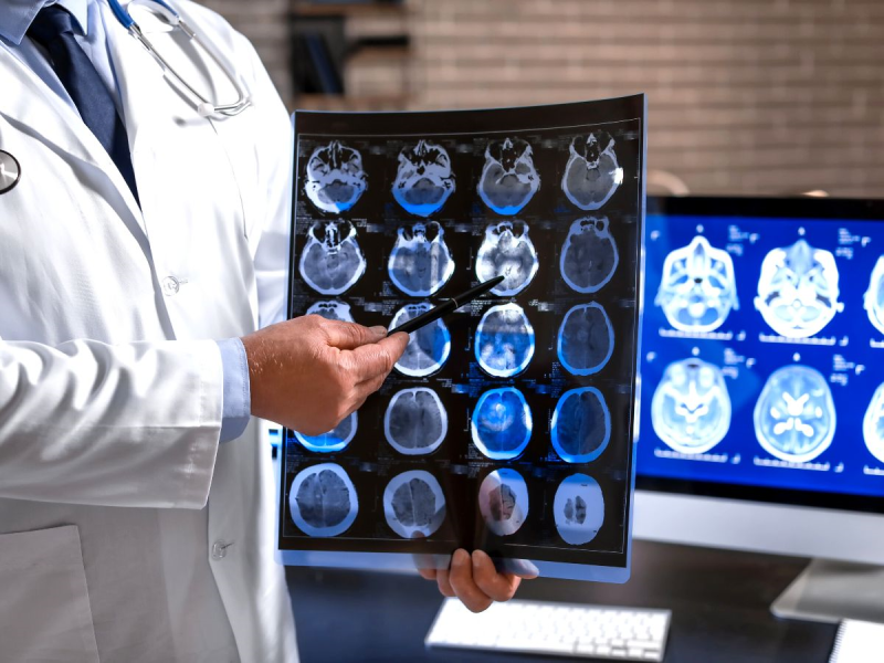 Brain Scans | Traumatic Brain Injury | Car A