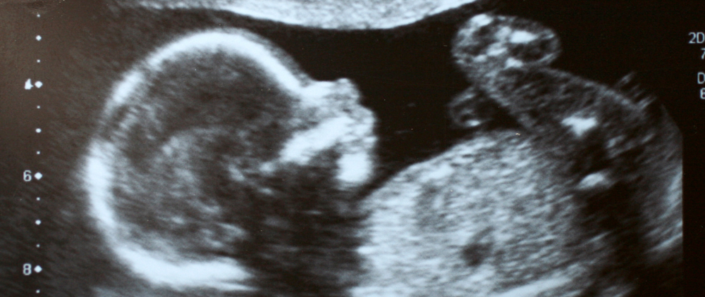 Trump, DeSantis and the Way Forward for the Pro-Life Community