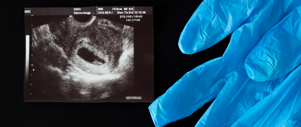 How Might a Potential Pro-life Law Define Christianity?