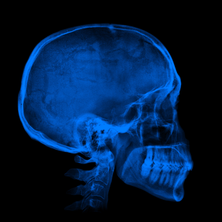 X-ray of a skull 