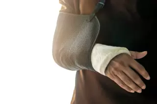 a closeup of a broken arm in a cast and a sling