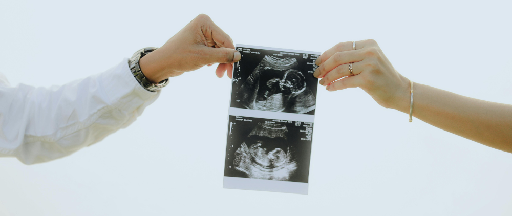Americans Don’t Want Unlimited Abortion… Even if the Abortion Lobby Tries to Hide It