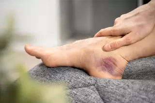 New Mexico slip and fall knee injury sprain