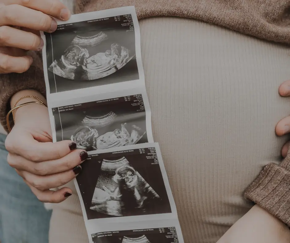 couple looking at their ultrasound images