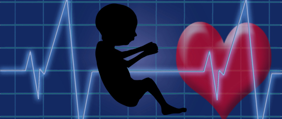Is the Fetal Heartbeat Bill Viable?