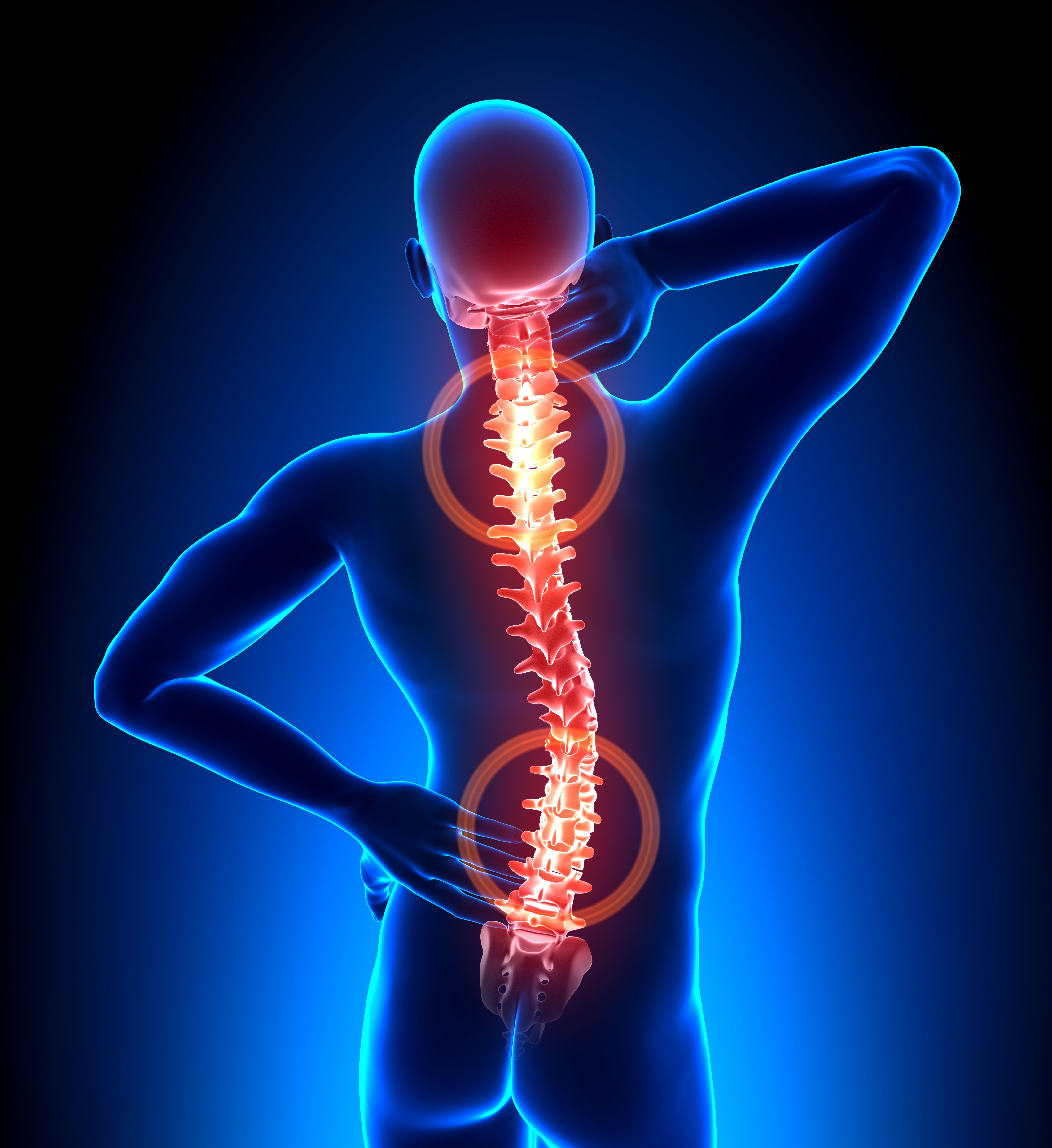 Top of spine and lower back highlighted to show where back pain can occur.